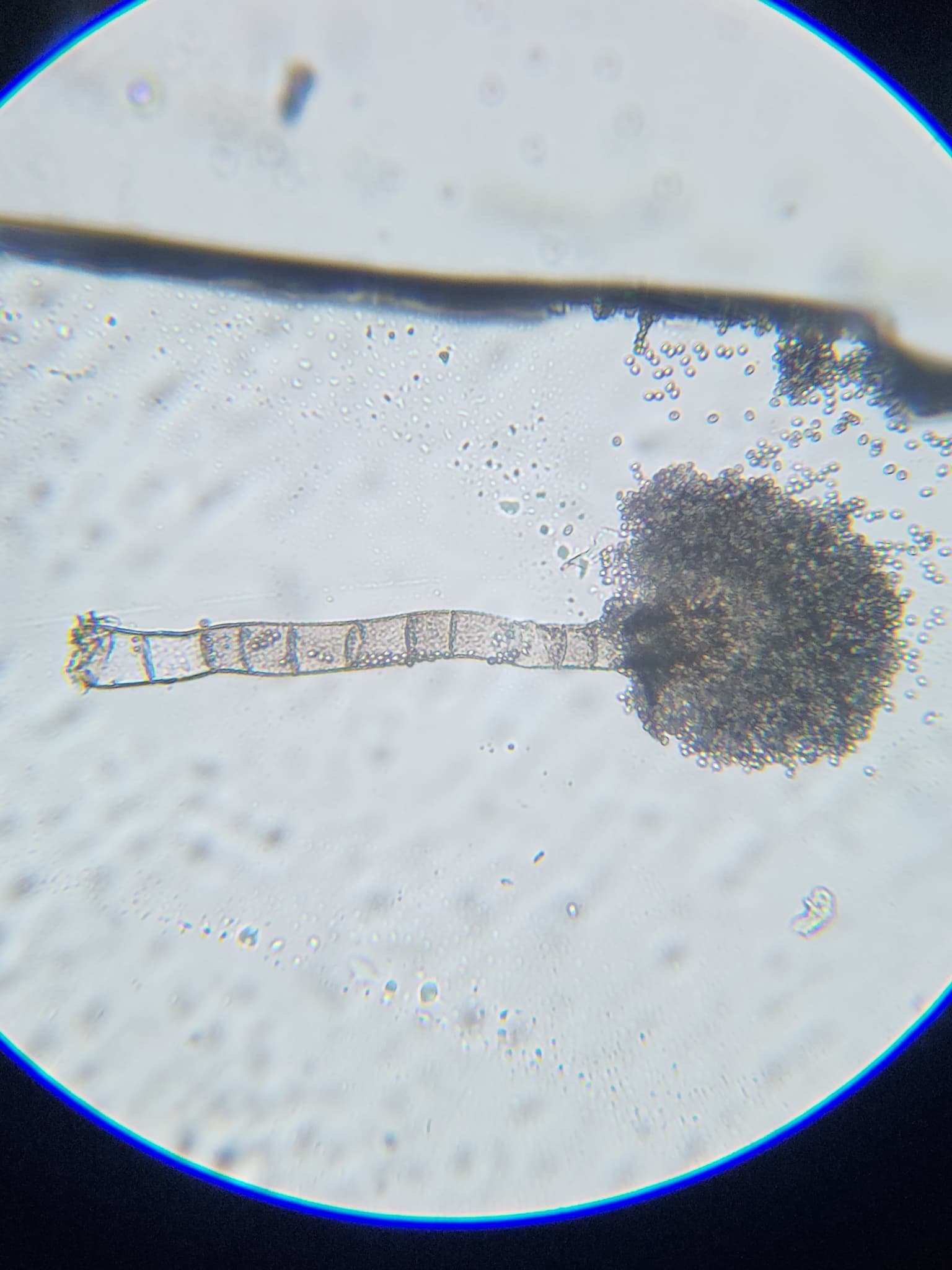 Plaga de ASPERGILUS, ASPERGILLUS SPP.