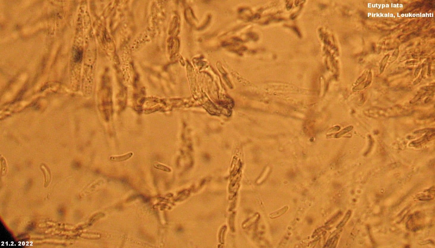 Plaga de EUTIPIOSIS DE LA VID, EUTYPA LATA