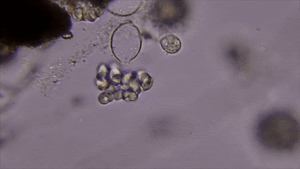 Plaga de PYTHIUM SPP.