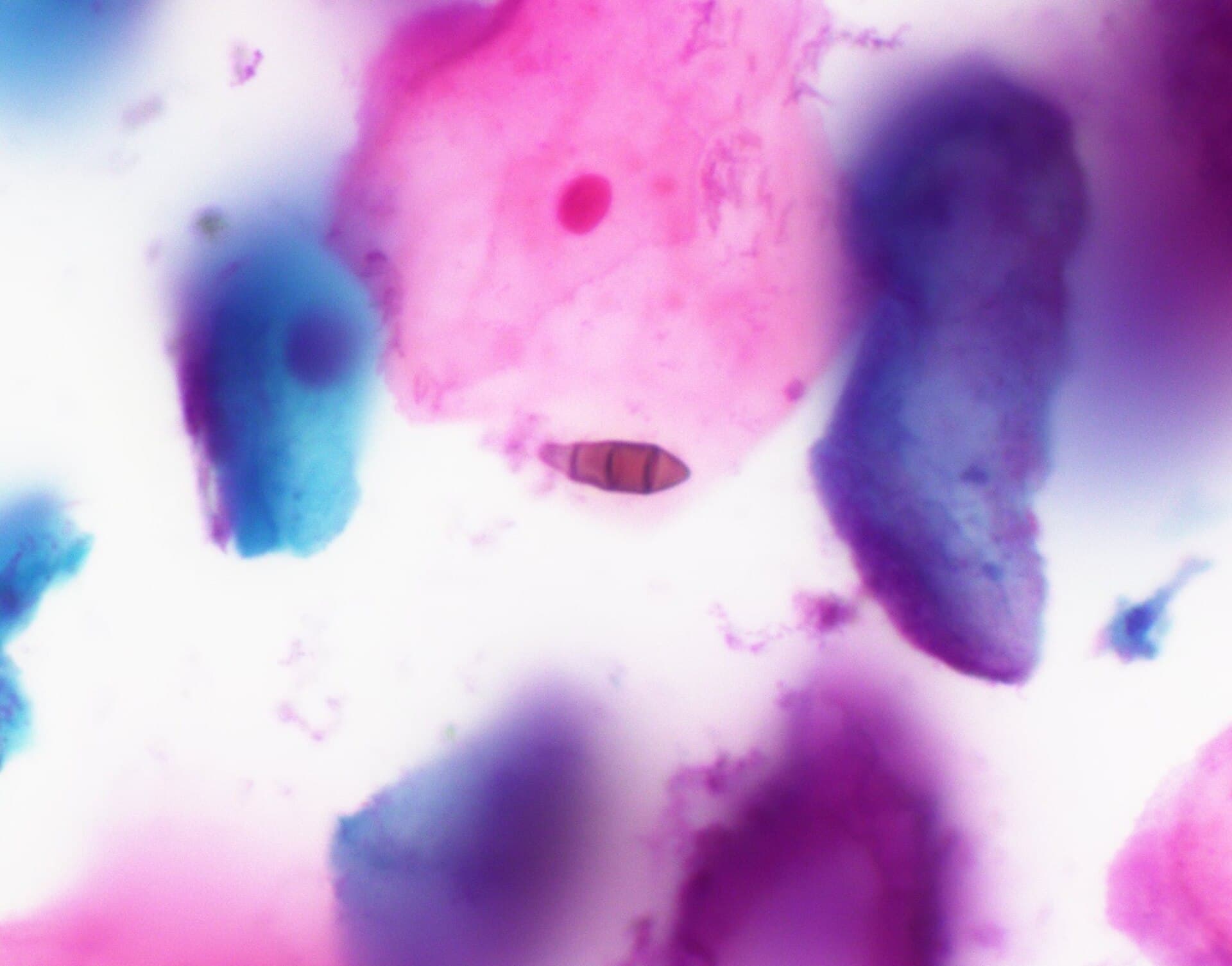 Plaga de ALTERNARIA SPP.