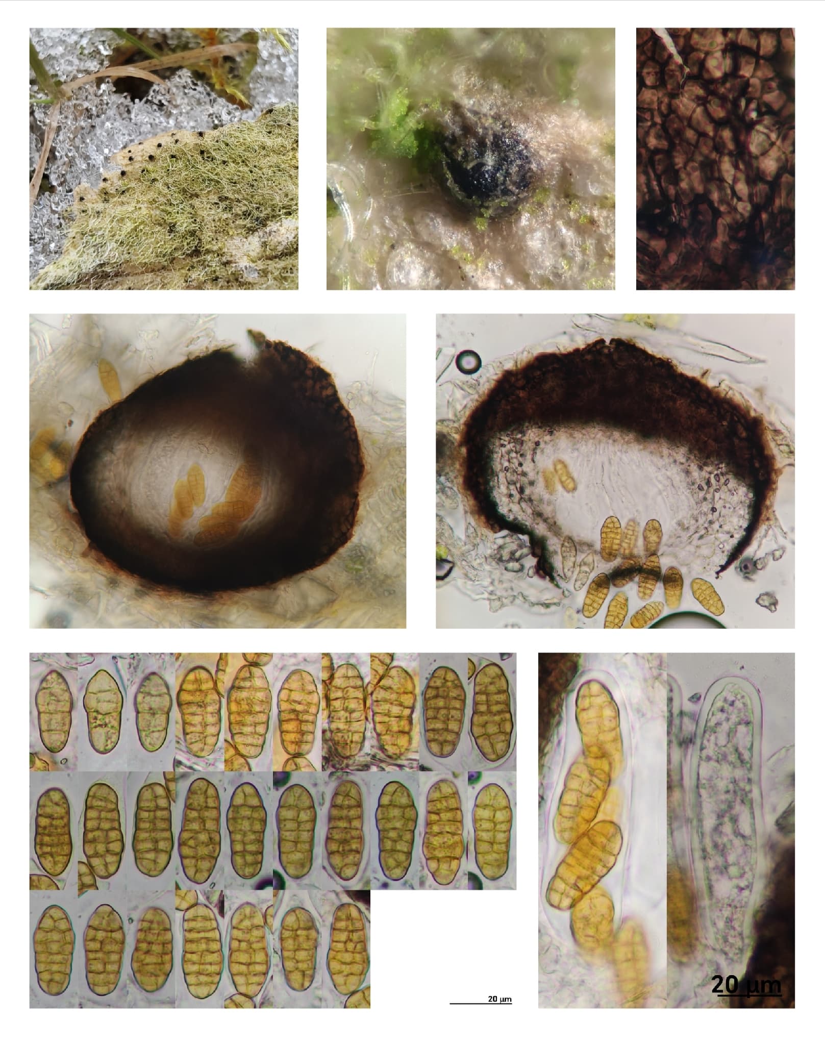 Plaga de ESTEMFILOSIS, MANCHA NEGRA, STEMPHYLIUM VESICARIUM